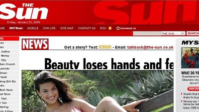 Marianie Bridi de Costa amputowano dłonie i stopy