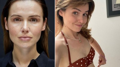 Marta Żmuda-Trzebiatowska pokazała, jak wygląda po dwóch ciążach: “Mam znamiona, rozstępy, blizny, przebarwienia (…)”