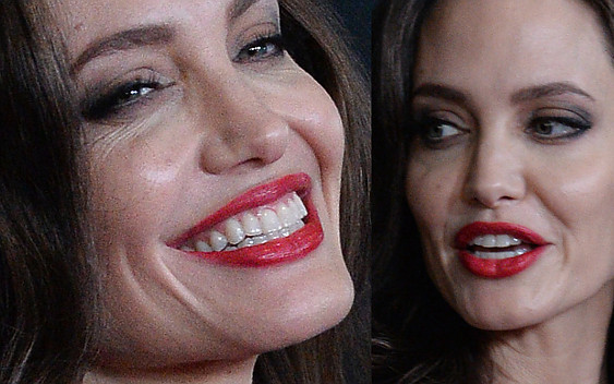 Angelina Jolie przyszła na imprezę, a internauci pytają, czy zmieniła klinikę