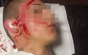 Pociął sobie twarz, by wyglądać jak Popek! (FOTO)