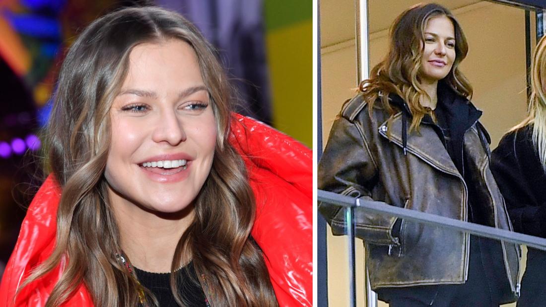 Anna Lewandowska przeszła operację plastyczną