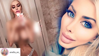 Stało się. Anella pokazała BIUST! Ma z nim problem…