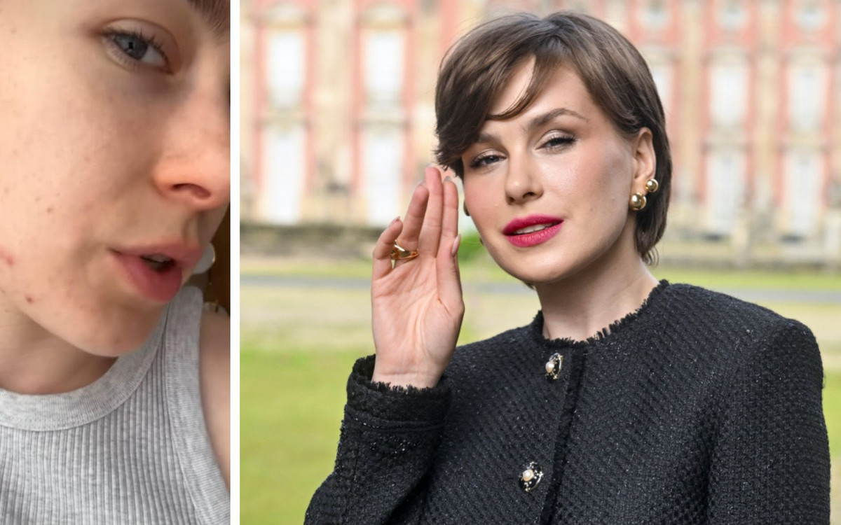 Anna-Maria Sieklucka mówi otwarcie o swoich problemach z cerą. Pokazała, jak teraz wygląda!