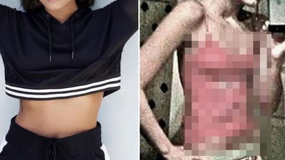 Znana wokalistka pokazała zdjęcie sprzed leczenia bulimii. Wyglądała STRASZNIE