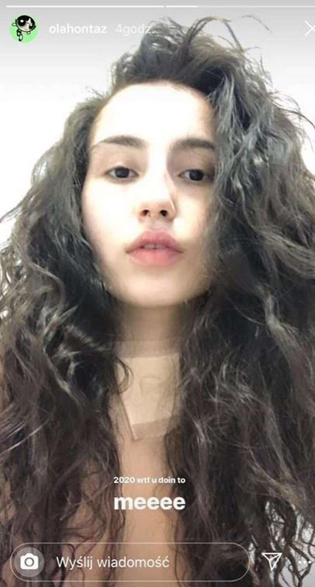 Ola Kowalska pokazała się po wyjściu ze szpitala - na szyi widać spory opatrunek. 