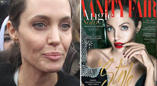 Angelina Jolie przyznała się do choroby, którą widać na twarzy