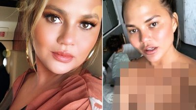 Dziwna narośl pojawiła się na dekolcie Chrissy Teigen!