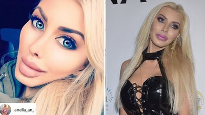 Anella zarzeka się: zrobiłam tylko piersi i nos! (VIDEO)