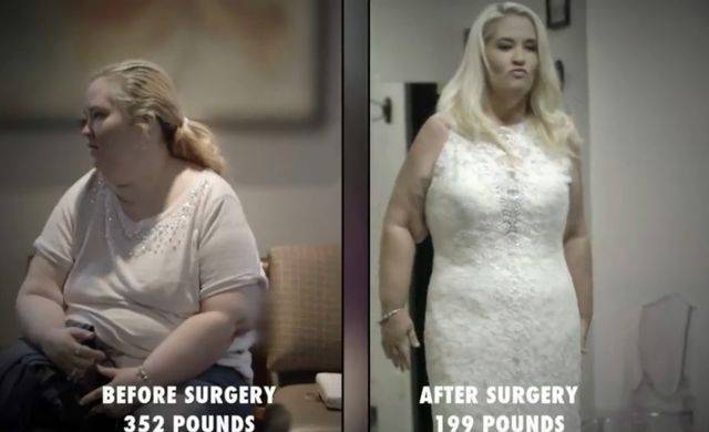 Piersi mamy June po schudnięciu 90 kg są w STRASZNYM STANIE