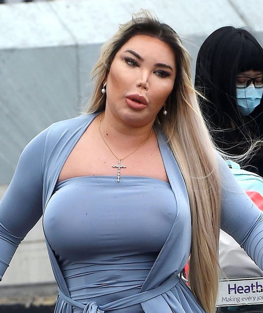 Ludzki Ken Rodrigo ALves powiększył biust