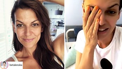 Alżbeta Lenska pokazała WIELKĄ bliznę po operacji