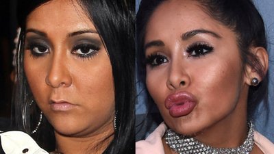 Gwiazdy, które trudno rozpoznać bo NAPOMPOWAŁY usta