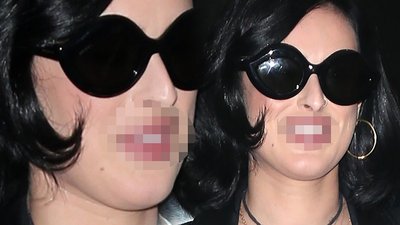 OMG! Co się stało z USTAMI Rumer Willis? (ZDJĘCIA)