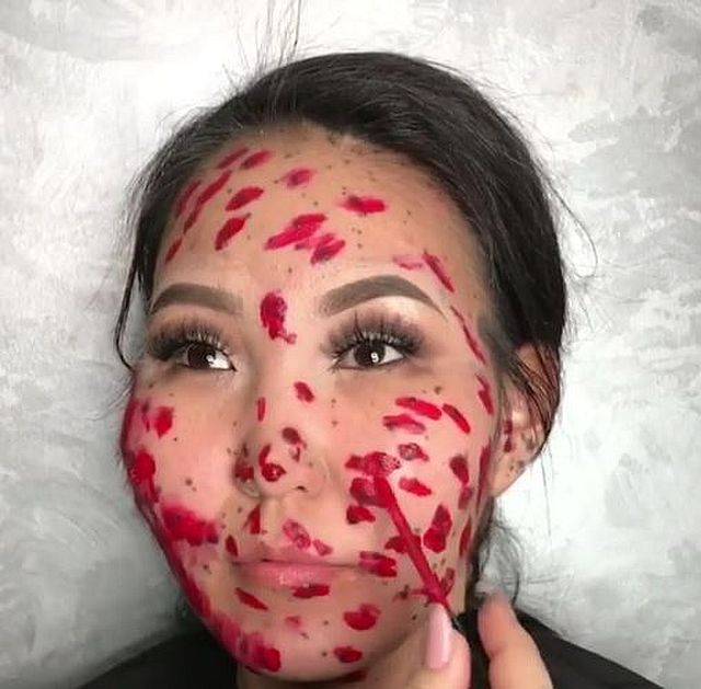 Ta dziewczyna miała całą twarz w ZNAMIONACH. Zobaczcie, CO jej pomogło!