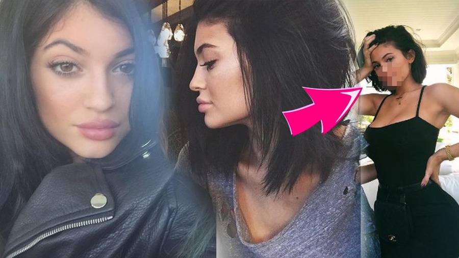 NEWS SEZONU! Kylie Jenner USUNĘŁA wypełniacze z UST