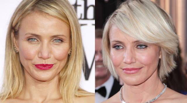 Jakich zabiegów urodowych żałują gwiazdy?