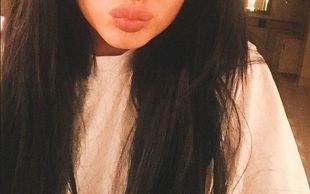 Niewiarygodny powód operacji plastycznych Kylie Jenner