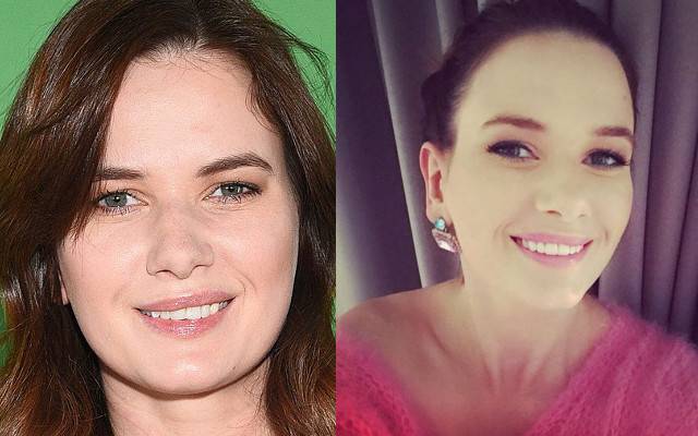 Jak zęby zmieniły twarze gwiazd