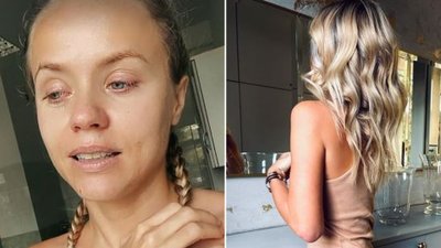 Anna Skura pokazuje, jak wygląda jej biust po operacji