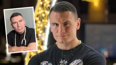 Nowe zęby Conana obiektem kpin. Ludzie nie mają litości. Aż w nim się zagotowało