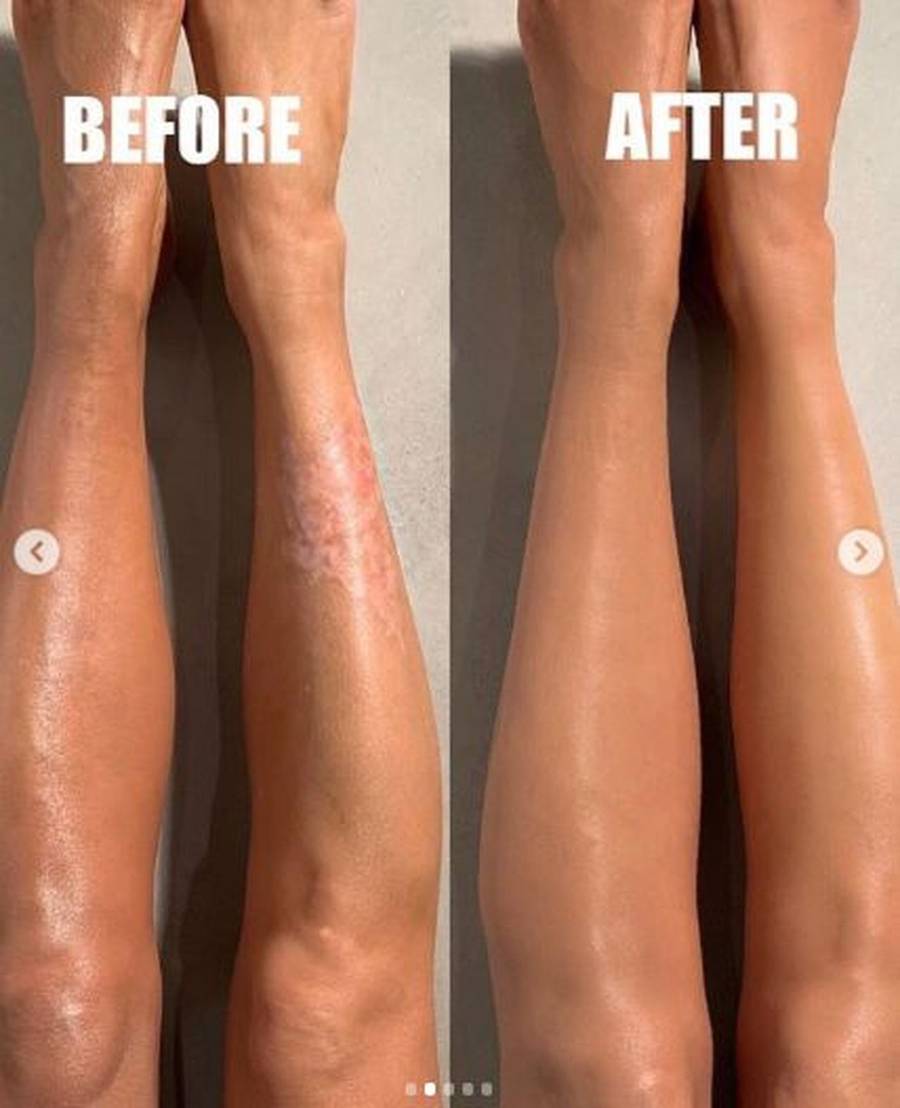 Kim Kardashian pokazała, jak maskuje łuszczycę