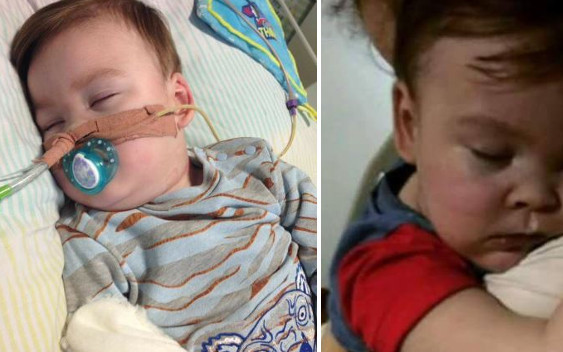 Odłączony od aparatury Alfie Evans oddycha samodzielnie. Rodzice WALCZĄ o niego