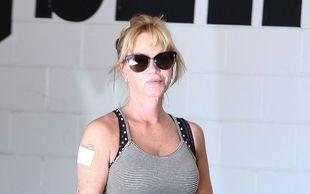 Pisali, że ma paskudne nogi (Instagram)