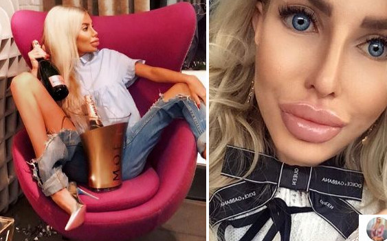 Anella pokłóciła się na wizji z chirurgiem plastycznym