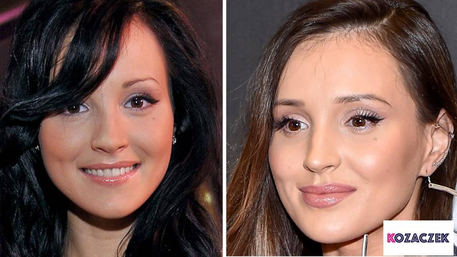 Które polskie gwiazdy powiększały usta? Porównujemy zdjęcia – STARE i NOWE