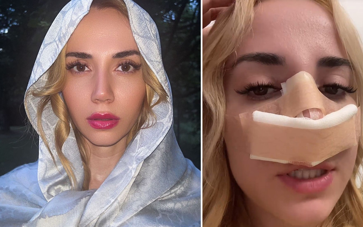 Marianna Schreiber poprawiła sobie nos! Fani: “Matko jedyna przecież dobrze było”