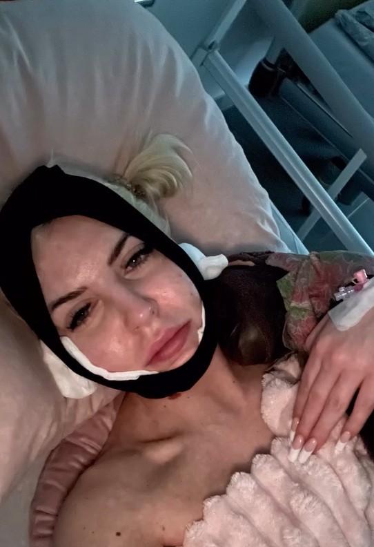 Julia von Stein opowiada o swoim cierpieniu po operacjach plastycznych, fot. Instagram
