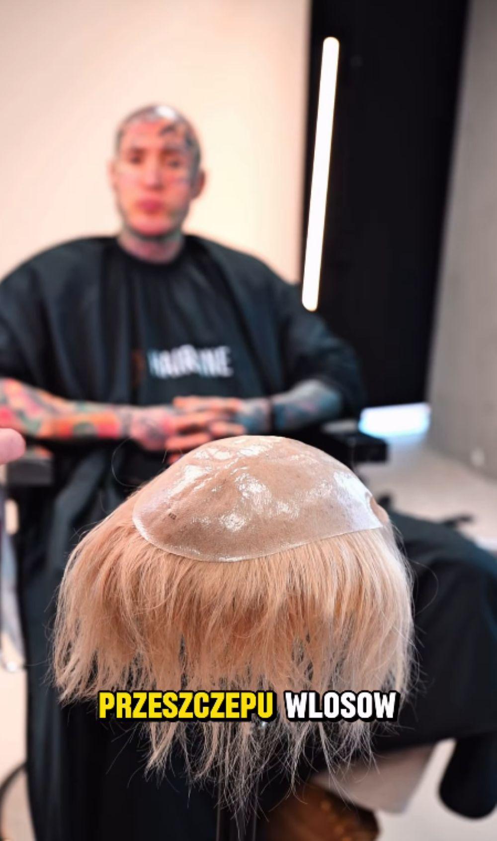 Stifler metamorfoza/Instagram/stifler16cm/hairline.com.pl