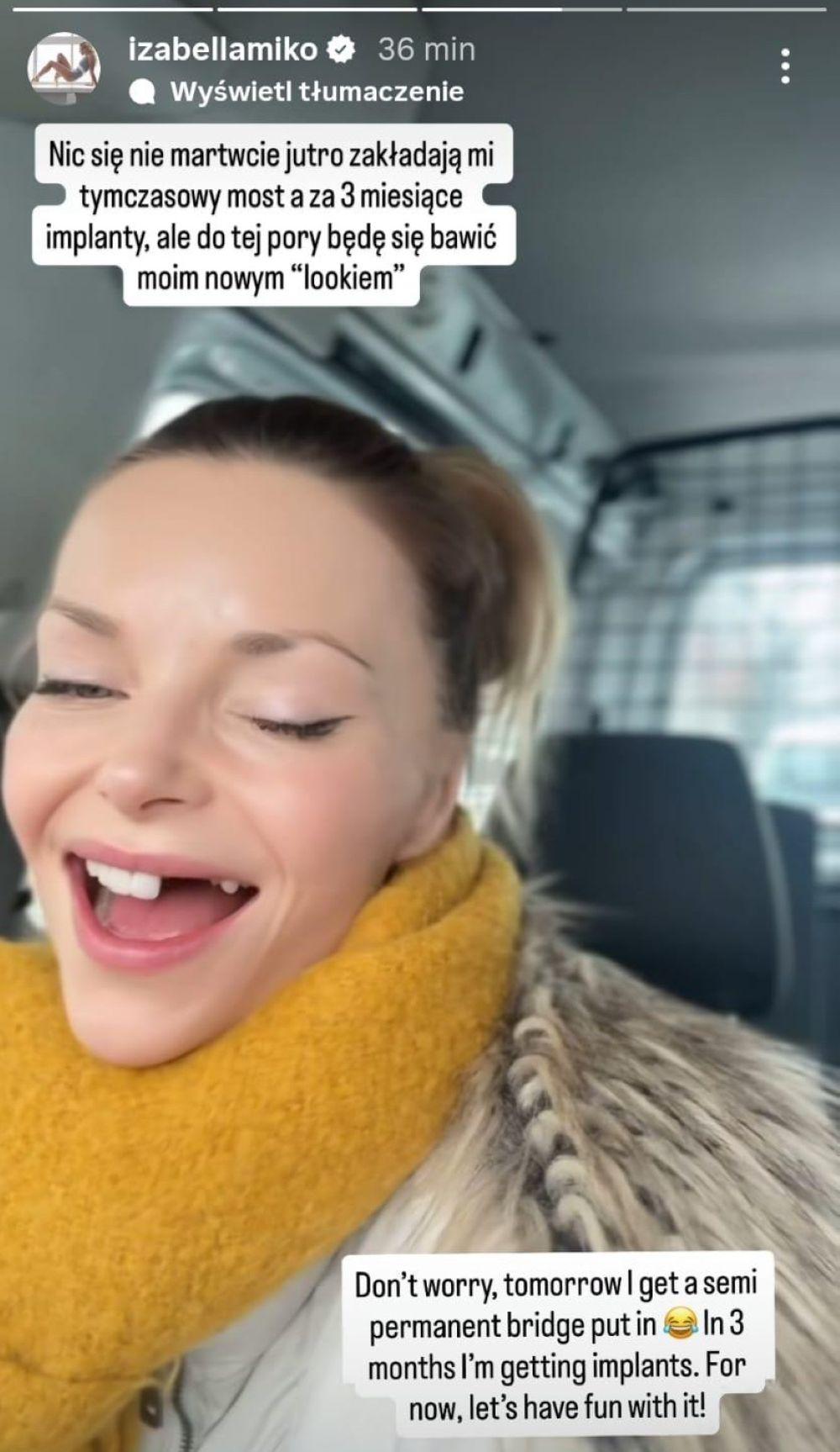 Iza Miko straciła zęby/Instagram/izabellamiko