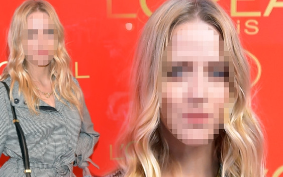 Pierwsze zdjęcia Jess ze ŚCIANKI po operacji! Jej twarz wygląda… inaczej