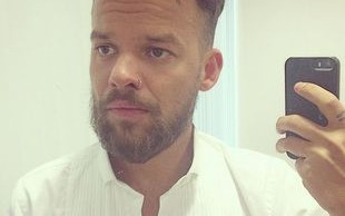 Michał Piróg powiększył usta (FOTO)