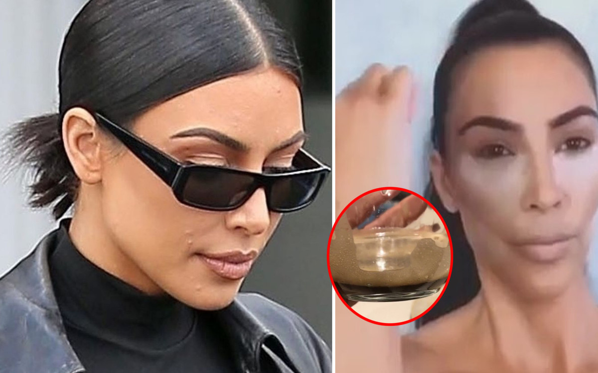 Kim Kardashian jest zdesperowana – łuszczyca zaatakowała jej twarz