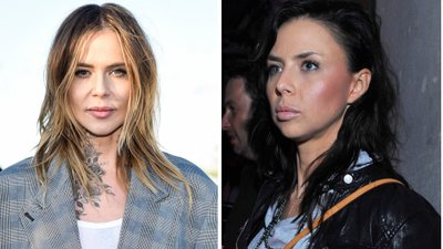 Jednak to nie dieta zmieniająca rysy twarzy? Maja Sablewska potwierdza, że przesadziła z medycyną estetyczną