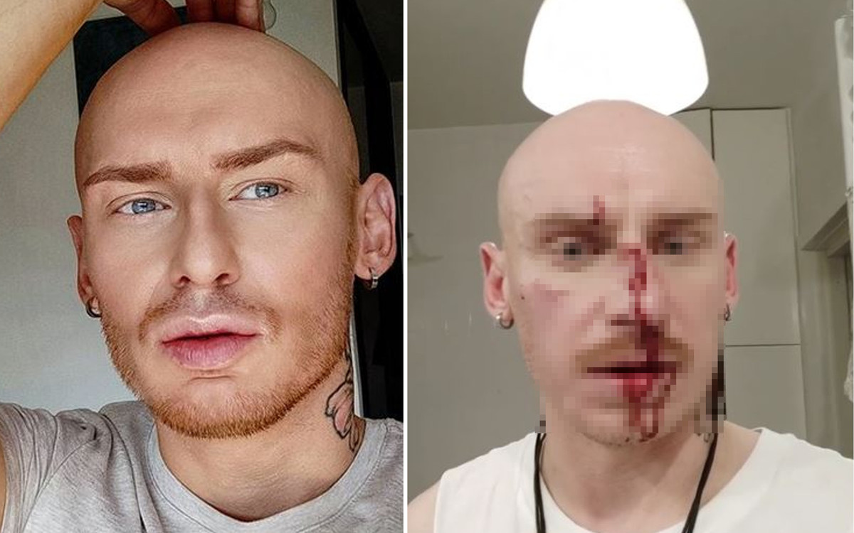 Gwiazda “Googlebox” i fryzjer Andrzeja Dudy został brutalnie POBITY. Nowe ustalenia w sprawie