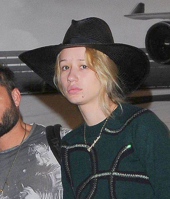 Iggy Azalea zoperowała nos i podbródek