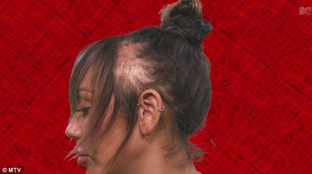 Ta gwiazdka przez lata nosiła doczepy, teraz płacze i pokazuje jak łysieje