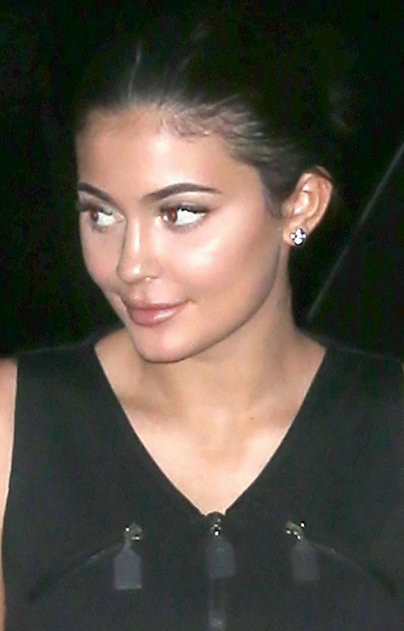 Małe USTA Kylie zmieniły jej twarz! Teraz wygląda zupełnie inaczej