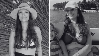 Nie żyje znana influencerka. Zmarła podczas operacji plastycznej