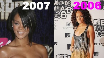 Rihanna ma implanty?