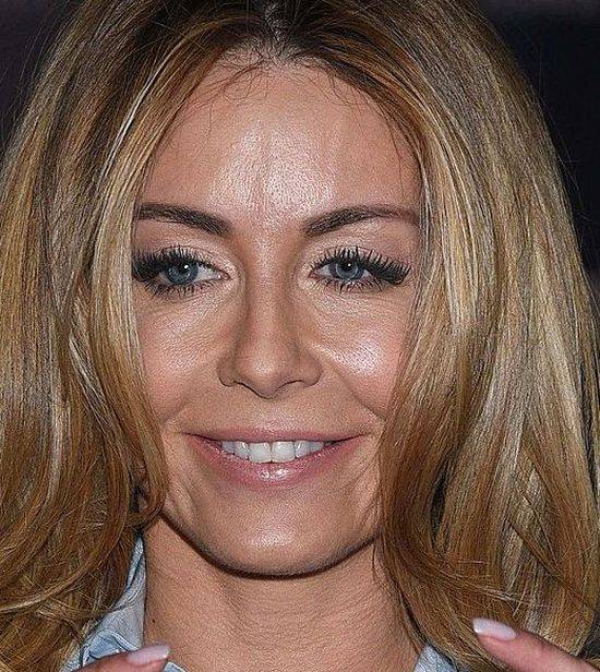 10 zaskakujących zbliżeń na twarz Małgorzaty Rozenek