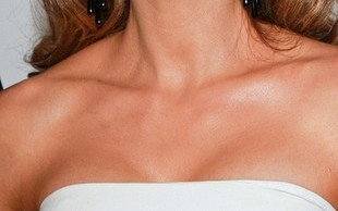 Odstające uszy Kate Beckinsale (FOTO)