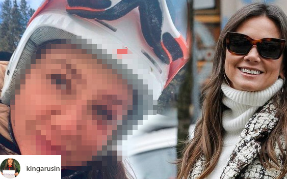 Kinga Rusin pokazała ZMASAKROWANĄ twarz po wypadku!