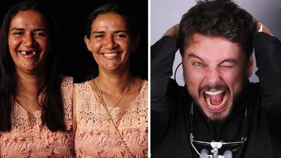 Dentysta wyleczył ZA DARMO zęby BIEDNYM. Efekt niebywały!