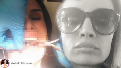 Desperacja! Kołakowska zdejmuje aparat dentystyczny i chwali się zębami