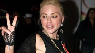 Casey Johnson zmarła z zaniedbania