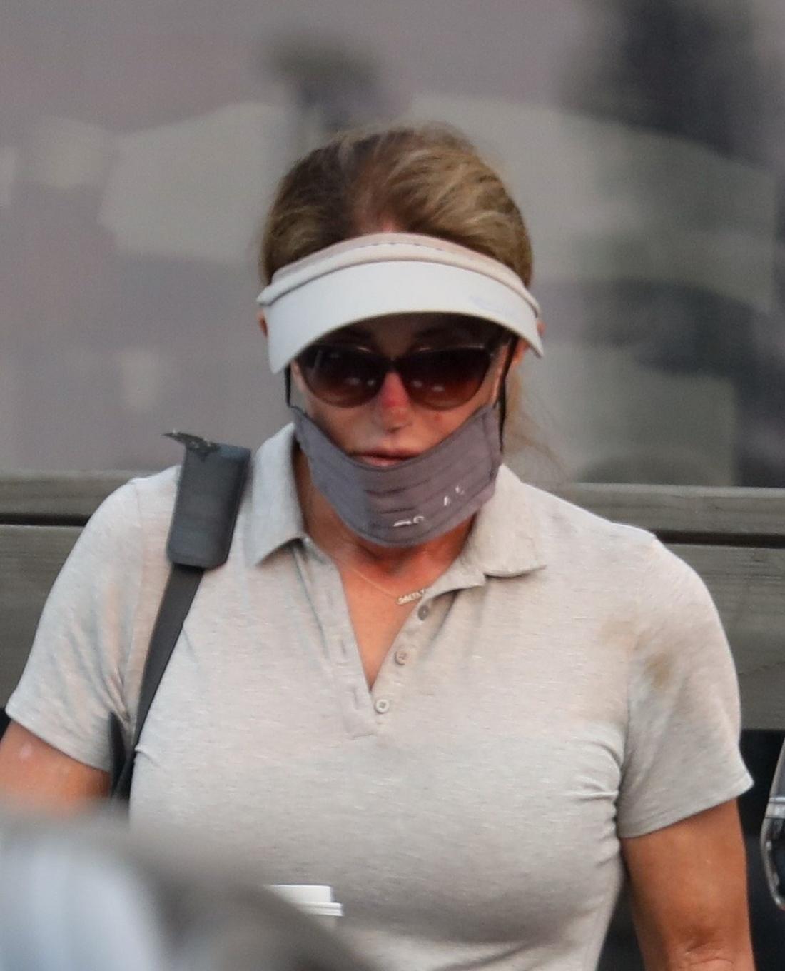 Caitlyn Jenner ze zmianą na nosie, fot. RMBI / BACKGRID / Backgrid USA / Forum